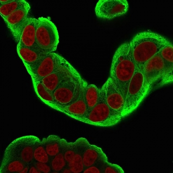 HSP27 Antibody / HSPB1