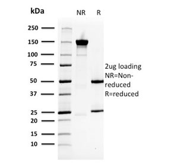 HSP27 Antibody / HSPB1