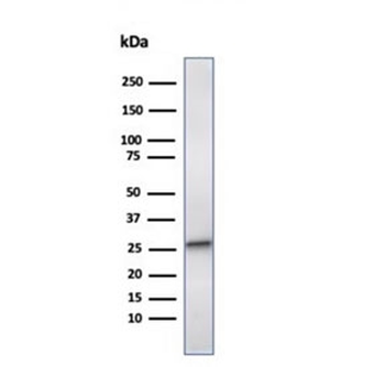 HSP27 Antibody / HSPB1