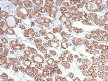 Cytokeratin 18 Antibody