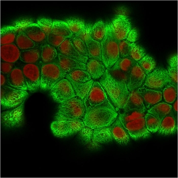 Cytokeratin 18 Antibody