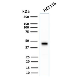 Cytokeratin 18 Antibody