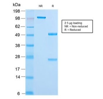 Cytokeratin 18 Antibody