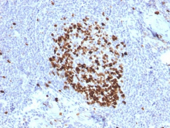 Ki67 Antibody