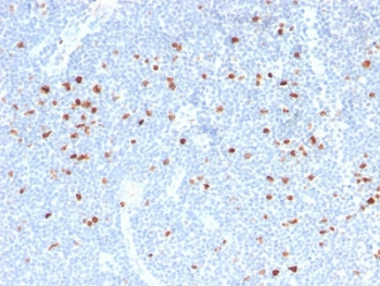 Ki67 Antibody