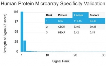 Ki67 Antibody