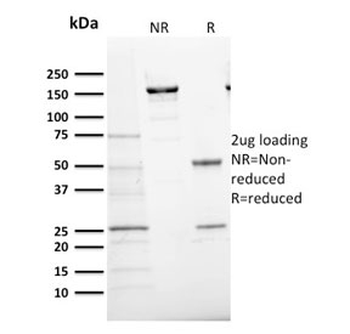 Ki67 Antibody
