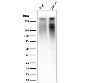 Ki67 Antibody