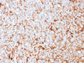 Mammaglobin A Antibody / SCGB2A2