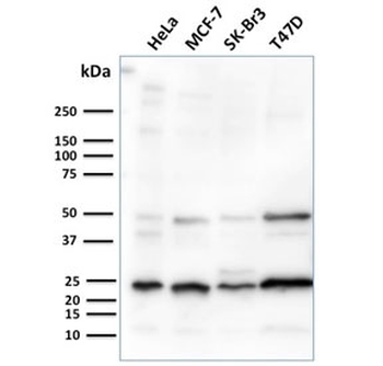 Mammaglobin A Antibody / SCGB2A2