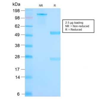 Mammaglobin A Antibody / SCGB2A2