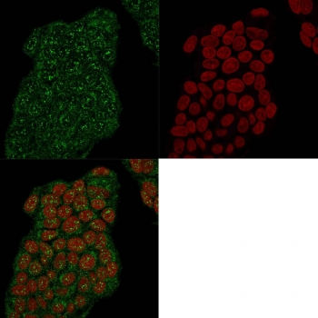 Mammaglobin A Antibody / SCGB2A2