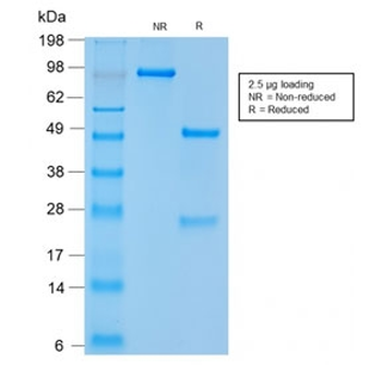 NCAM / CD56 Antibody