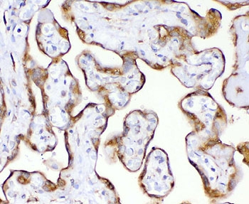 Recombinant TIMP2 Antibody