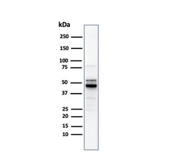 Ornithine Decarboxylase Antibody / ODC1