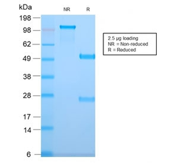 DOG1 Antibody / TMEM16A / ANO1