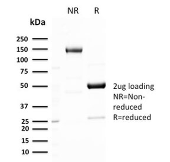 GLUT1 Antibody / SLC2A1