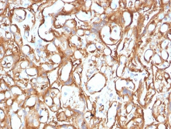 Ezrin Antibody / EZR