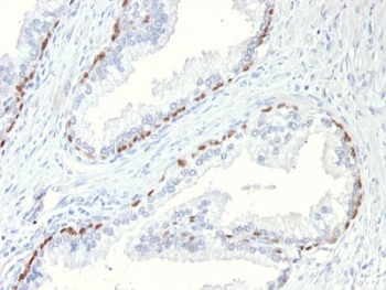 p63 Antibody / Tumor protein 63