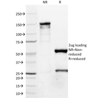 p63 Antibody / Tumor protein 63