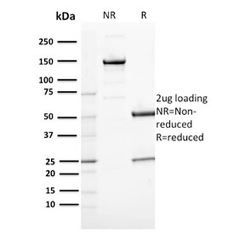 CD163 Antibody