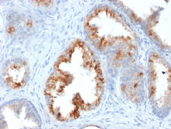 AMACR / p504S Antibody (Prostate Cancer Marker)