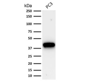 AMACR / p504S Antibody (Prostate Cancer Marker)