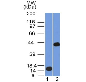 AMACR / p504S Antibody (Prostate Cancer Marker)