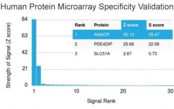 AMACR / p504S Antibody (Prostate Cancer Marker)