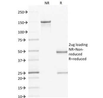 AMACR / p504S Antibody (Prostate Cancer Marker)