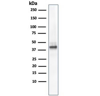AMACR / p504S Antibody (Prostate Cancer Marker)