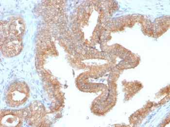 AMACR / p504S Antibody (Prostate Cancer Marker)