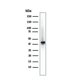AMACR / p504S Antibody (Prostate Cancer Marker)