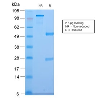 CELA3B Antibody / Elastase 3B