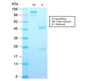 Growth Hormone Antibody / GH1