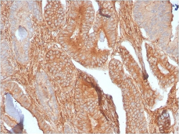 CD81 Antibody