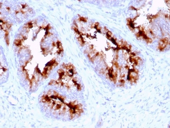 Folate Hydrolase 1 Antibody / FOLH1 / PSMA