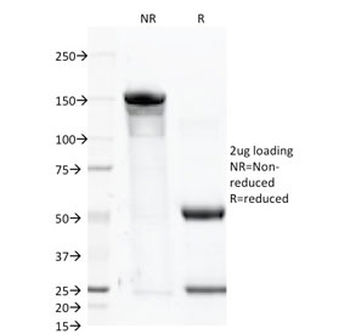 Folate Hydrolase 1 Antibody / FOLH1 / PSMA