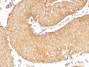 Calcineurin Antibody / PPP3CA