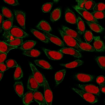 SPTBN2 Antibody / Spectrin beta III