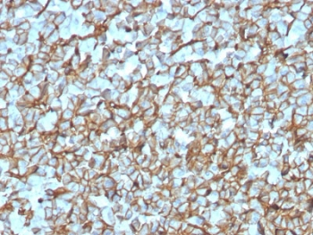 SPTBN2 Antibody / Spectrin beta III