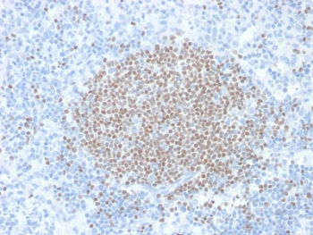 SULT1E1 Antibody / Estrogen Sulfotransferase