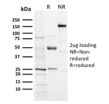 Aurora B Antibody / AURKB