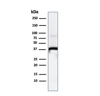 Annexin A1 Antibody
