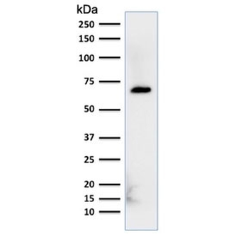 Albumin Antibody / ALB