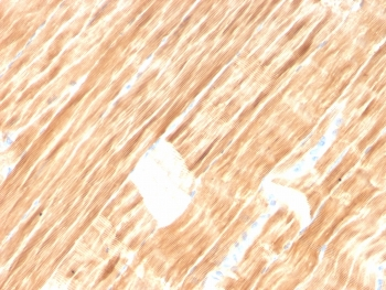 ACTN2 Antibody / Alpha Actinin 2 / Sarcomeric Alpha Actinin