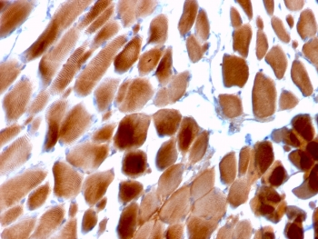 ACTN2 Antibody / Alpha Actinin 2 / Sarcomeric Alpha Actinin