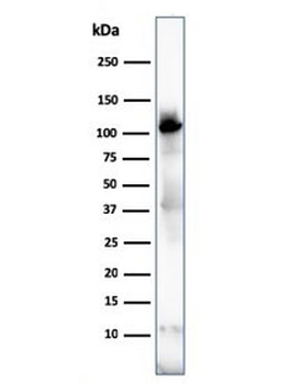 ACTN2 Antibody / Alpha Actinin 2 / Sarcomeric Alpha Actinin