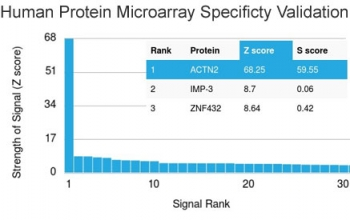 ACTN2 Antibody / Alpha Actinin 2 / Sarcomeric Alpha Actinin