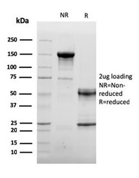 ACTN2 Antibody / Alpha Actinin 2 / Sarcomeric Alpha Actinin